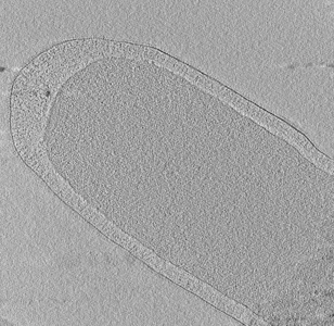 Cryo-ET of Thermotoga maritima by Sexton et al. brought new insight to the evolution of bacterial membranes (2023)