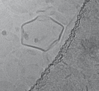 Schlosser et al. develop lipid-based delivery of osteoporosis drug, confirmed through cryo-TEM